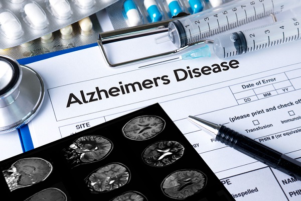 Further research is needed to determine the potential of TMS for Alzheimer’s treatment