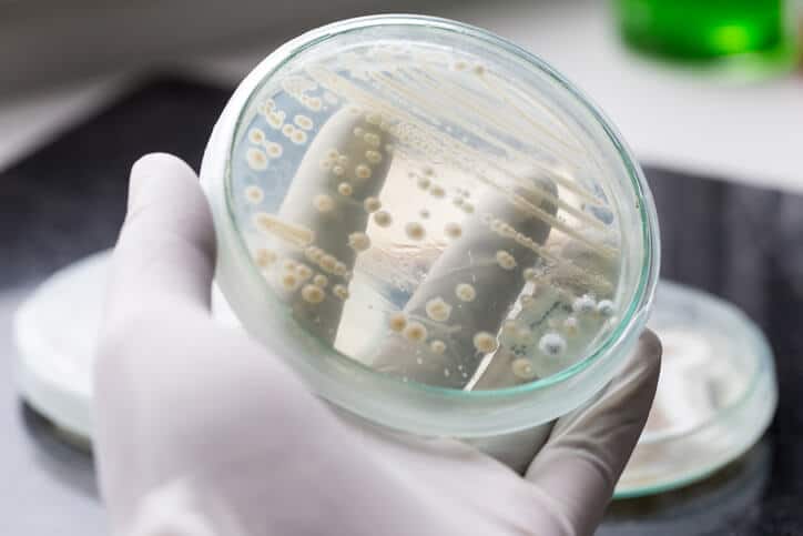 Micro-organisms found in food on petri dish ready to be examined under a microscope during food safety training