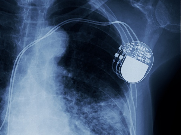 Pacemakers are an example of medical devices and fall under these regulations